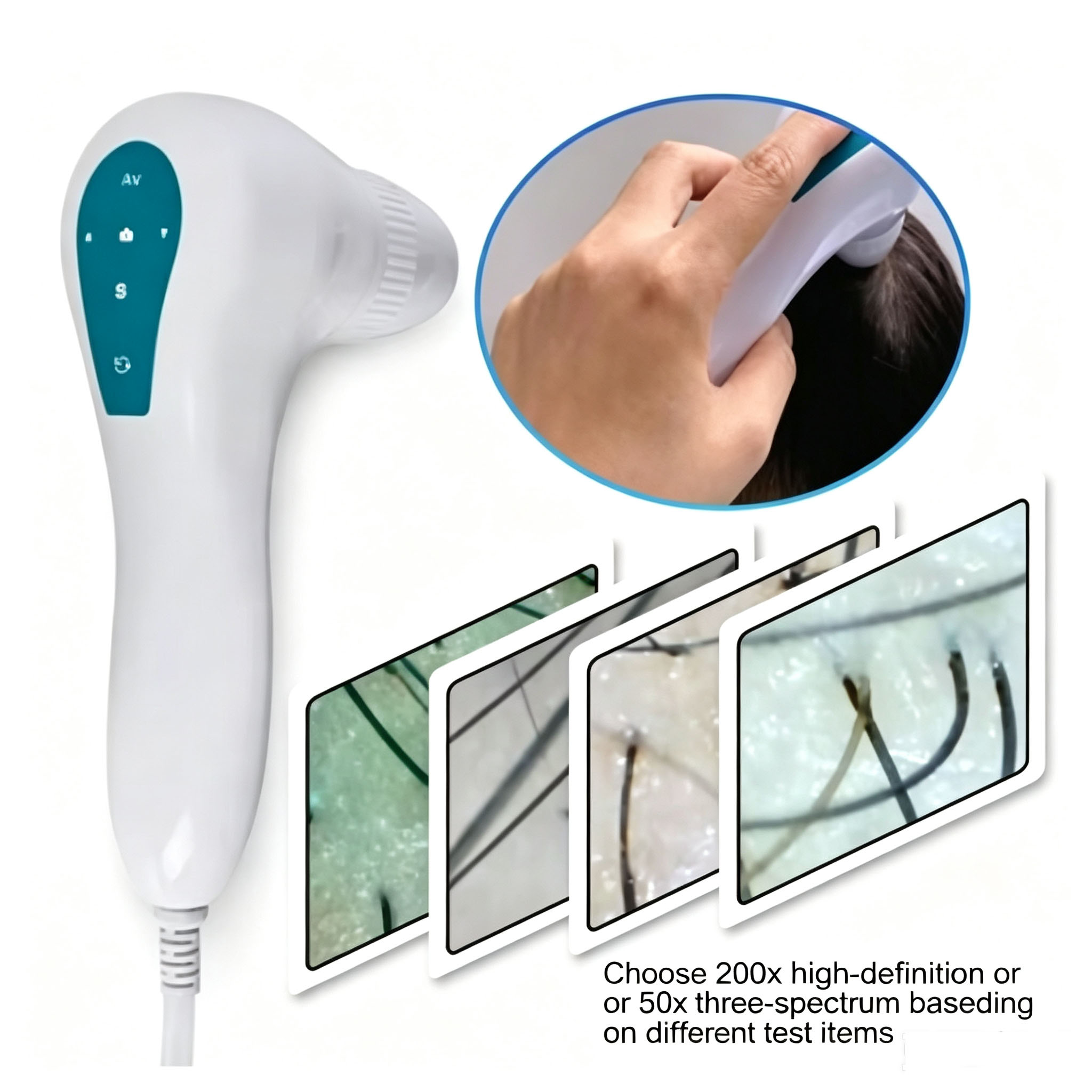 Anti Hair Loss Scalp Hair Foll - Hair Care review and price